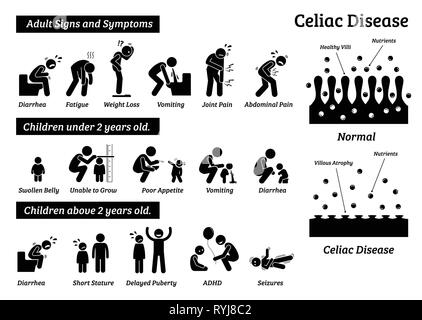 Coeliac disease or celiac disease. small bowel showing coeliac disease ...