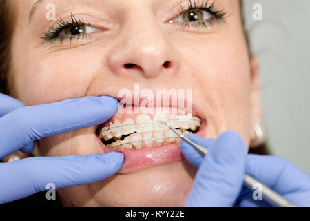 Orthodontist tightening braces. Stock Photo