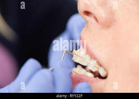 Orthodontist tightening braces. Stock Photo