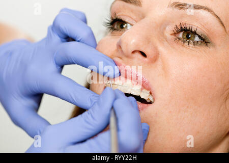 Orthodontist tightening braces. Stock Photo