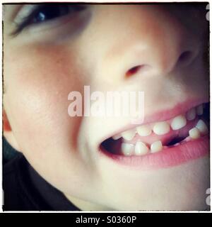 Child missing his two bottom teeth, close up of mouth of boy showing his two bottom teeth missing Stock Photo