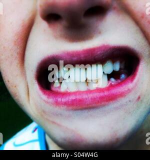 Boy crying and showing his teeth Stock Photo