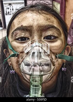 Little girl receiving a breathing treatment with a nebulizer after an accident. Stock Photo