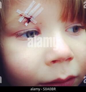 Boy with Steri-strips across a cut on his Eyebrow Stock Photo