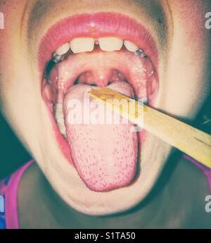 View of wide open mouth and tongue depressor checking child’s throat for virus Stock Photo