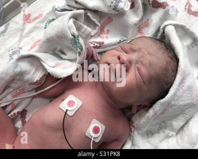 Newborn baby boy, born by cesarean. In hospital with heart electrodes on his chest. Stock Photo