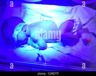 Newborn in phototherapy. Stock Photo