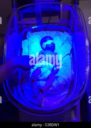 Newborn baby holding his father’s finger during phototherapy to treat jaundice. Stock Photo