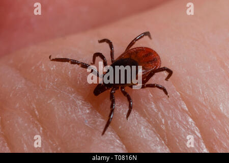 castor bean tick, human skin, (Ixodes ricinus) Stock Photo