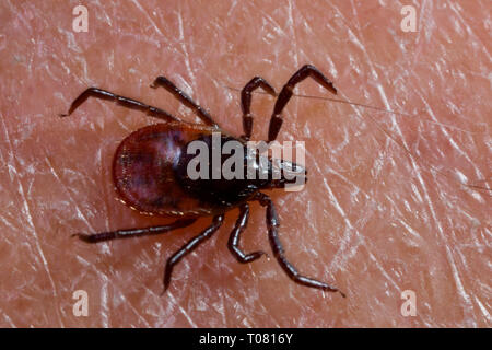 castor bean tick, human skin, (Ixodes ricinus) Stock Photo