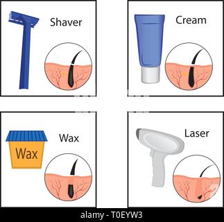 Hair removal methods and its result on a girl s body vector illustration Stock Vector Image Art Alamy