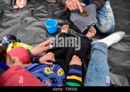 March 21, 2019 - Srinagar, Jammu and Kashmir, India - A young Kashmiri patient seen with leeches on his feet during the leech treatment.A traditional health worker uses leeches to suck impure blood as part of a treatment at Hazratbal on the banks of the Dal Lake on the outskirts of Srinagar Summer capital of Indian administered Kashmir. Every year traditional health workers in Kashmir use leeches to treat people for itchy, painful lumps that develop on the skin called chilblains acquired during winter. Thousands of patients suffering from various skin problems receives leech treatment at Hazr Stock Photo