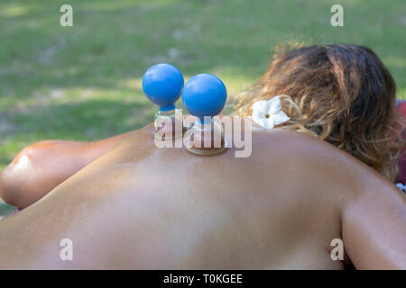 Massage with jars of cellulite on the body of the patient. Treatment of excess weight outdoors in nature. Anti-cellulite massage of the hips with the  Stock Photo