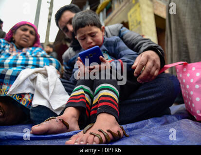 March 21, 2019 - Srinagar, Jammu and Kashmir, India - A young Kashmiri patient seen with leeches on his feet during the leech treatment..A traditional health worker uses leeches to suck impure blood as part of a treatment at Hazratbal on the banks of the Dal Lake on the outskirts of Srinagar Summer capital of Indian administered Kashmir. Every year traditional health workers in Kashmir use leeches to treat people for itchy, painful lumps that develop on the skin called chilblains acquired during winter. Thousands of patients suffering from various skin problems receives leech treatment at Hazr Stock Photo