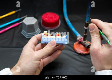 Dental technician or dentist man working with dentures in a laboratory with wax on a jaw model Stock Photo