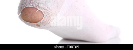 Ripped white sock on male leg isolated Stock Photo