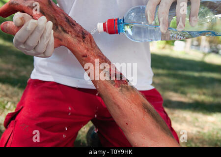 Paramedic cooling third degree hand burns with water. Simulated exercise, professional medical make-up, not a real injury. Stock Photo