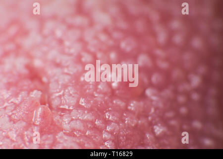 Super macro surface of tongue candidiasis overgrowth Stock Photo