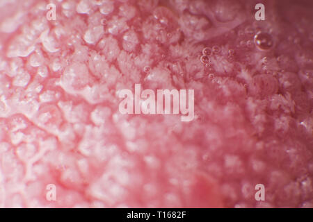 Super macro surface of tongue candidiasis overgrowth Stock Photo