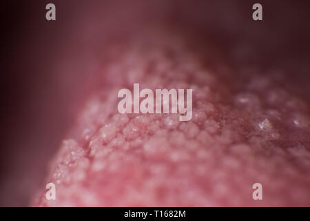 Super macro surface of tongue candidiasis overgrowth Stock Photo