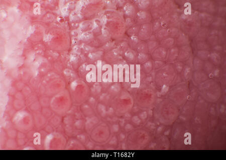 Super macro surface of tongue candidiasis overgrowth Stock Photo