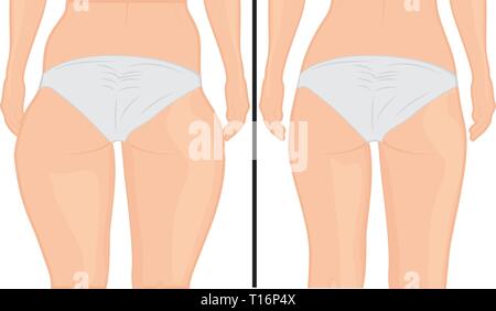 Fat Hips Before Vector Images (81)