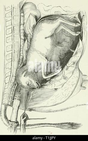 The diseases and disorders of The diseases and disorders of the ox, with some account of the diseases of the sheep  diseasesdisorderox00gres Year: 1889 Stock Photo