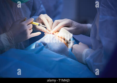 Medical Team Performing Surgical Operation in Modern Operating Room. Stock Photo