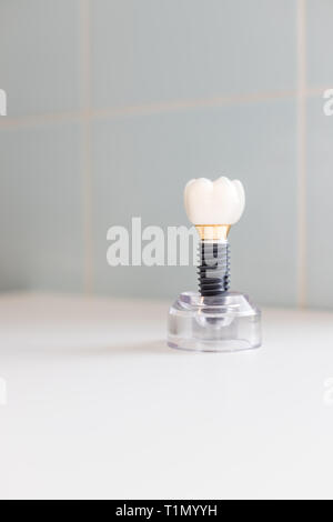 teeth model showing an implant crown bridge model .Dental Industry. Dental Implant or endosseous tooth prosthetic concept with an orthodontic crown Stock Photo