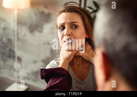 woman with bruises Stock Photo - Alamy