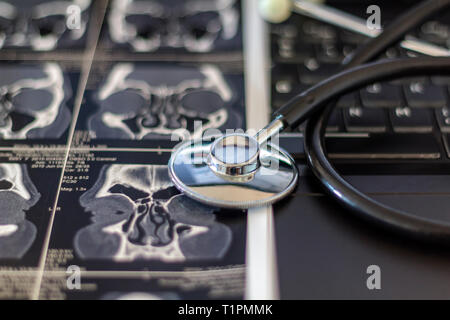 Medical stethoscope and CT scan. on laptop computer Medical concept Stock Photo