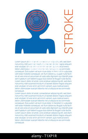 Stroke article page template with text space. Ischemic brain disease scientific research. Medical magazine page concept. Neurology disorder symptoms banner, poster, brochure design layout Stock Vector