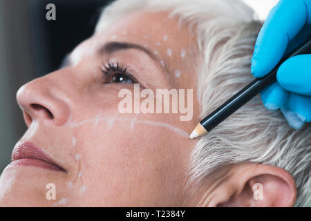 Doctor's hand in blue surgical glove marking senior women's face for cosmetic injections. Stock Photo