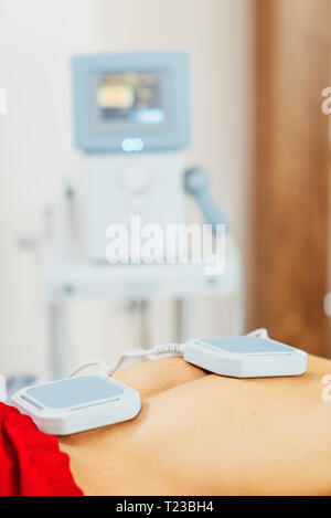 Magnetotherapy. Magnets on patient's back. Stock Photo