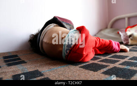 Sanaa, Yemen. 1st Apr, 2019. A malnourished child lies in bed as he receives medical treatment at a malnutrition care center in Sanaa, Yemen, on April 1, 2019. According to the United Nations Children's Fund (UNICEF), around 394,000 Yemeni children under 5 years old are suffering from severe acute malnutrition and need treatment. Credit: Mohammed Mohammed/Xinhua/Alamy Live News Stock Photo