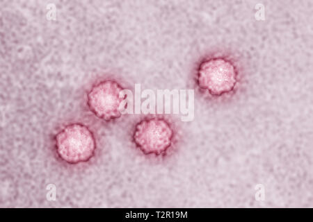 Hepatitis A virus Stock Photo