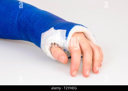 Symbol picture, wrist with plaster cast, Germany Stock Photo