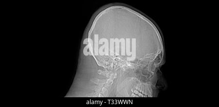 Ct scan report of head and skull, close up Stock Photo - Alamy