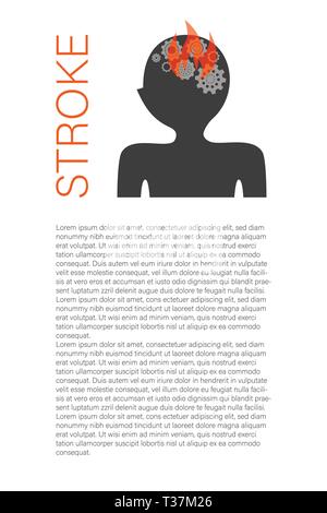 Stroke article page template with text space. Ischemic brain disease scientific research. Medical magazine page concept. Neurology disorder symptoms banner, poster, brochure design layout Stock Vector