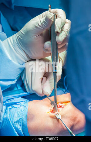 Group of orthopedic surgeons performing surgery on a patient arm Stock Photo