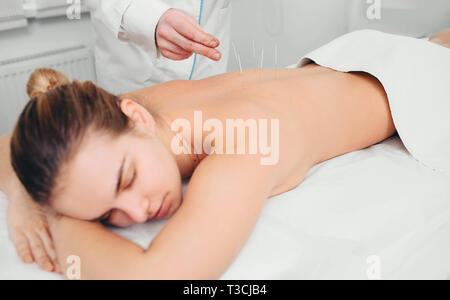 Acupuncturist inserting a needle into a female back. patient having traditional Chinese treatment using needles to restore an energy flow through spec Stock Photo
