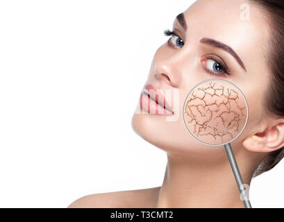 Female face showing dry facial skin using magnify glass. Cracked dry skin without moistening Stock Photo