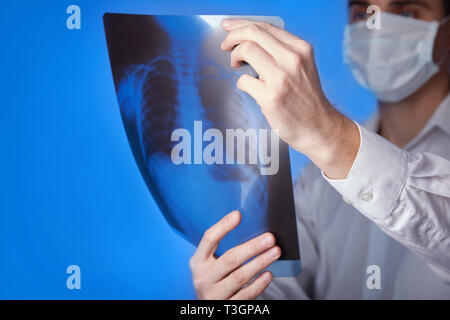 Male doctor in mask and  white coat holding  x-ray or roentgen of lungs, fluorography,  image  on blue background Stock Photo