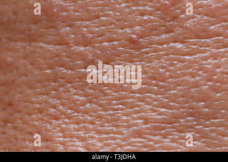 male face oily skin large pores with acne texture for backgroun Stock Photo