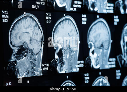 Head MRI scan, personal data removed Stock Photo