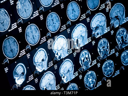 Head and neck MRI scan, patient's and clinic's info removed, toned image Stock Photo