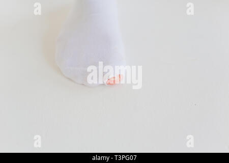 Hole in gray sock shows big female toe. Stock Photo