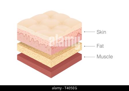 Anatomy of human Skin layer, fat and muscle layer in isometric style. Stock Vector