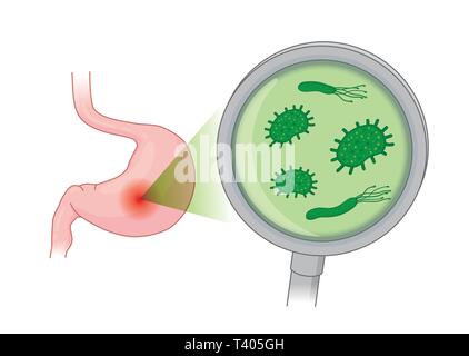 Looking Bacterial in human stomach with with Magnifying glass. Stock Vector