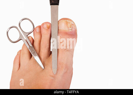 Foot with toenail fungus, scissors and file-isolated Stock Photo